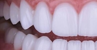 A estética do sorriso entrou no excesso