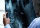 ONG Mude a Curva realiza mutirão de cirurgias de escoliose em parceria com HCFMB e Medtronic, ampliando acesso pelo SUS   
