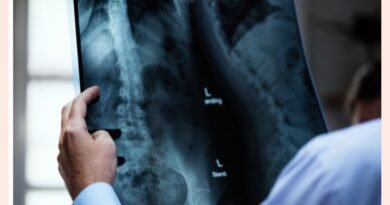 ONG Mude a Curva realiza mutirão de cirurgias de escoliose em parceria com HCFMB e Medtronic, ampliando acesso pelo SUS   