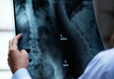 ONG Mude a Curva realiza mutirão de cirurgias de escoliose em parceria com HCFMB e Medtronic, ampliando acesso pelo SUS   