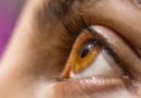 Junho Violeta alerta para riscos do hábito de coçar os olhos e importância do diagnóstico do ceratocone