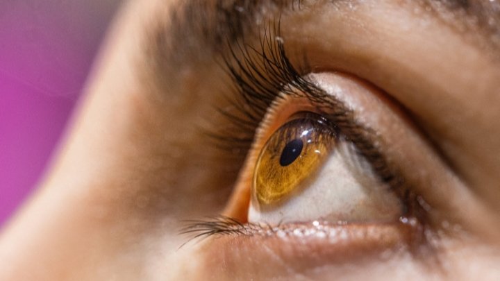 Junho Violeta alerta para riscos do hábito de coçar os olhos e importância do diagnóstico do ceratocone