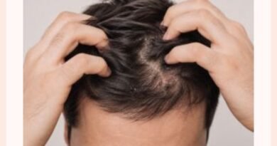Especialista alerta para cuidados com o couro cabeludo masculino