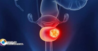 Novo tratamento sem quimioterapia tradicional revoluciona cura do câncer de bexiga, revela estudo (mais informações e incrições aqui 👇)