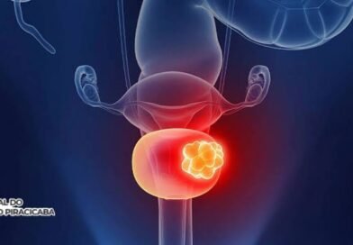 Novo tratamento sem quimioterapia tradicional revoluciona cura do câncer de bexiga, revela estudo (mais informações e incrições aqui 👇)
