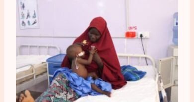Mais de 87 mil crianças com desnutrição aguda foram tratadas por Médicos Sem Fronteiras no norte da Nigéria entre janeiro e agosto deste ano